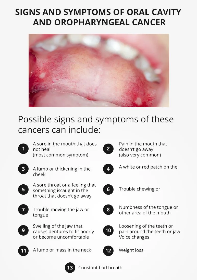 sign-and-symtomps-of-mouth-cancer
