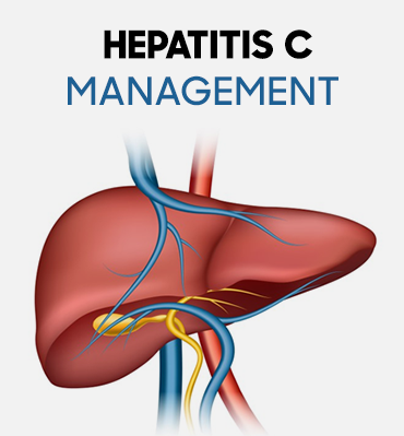 Hepatitis C Management 
